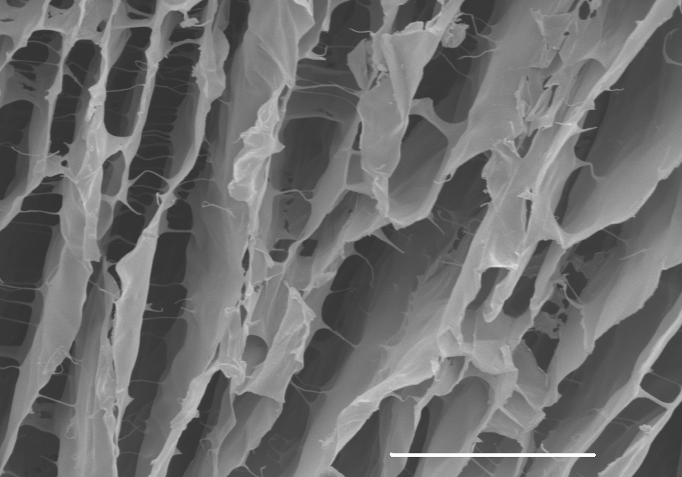 Brain Tissue Regeneration