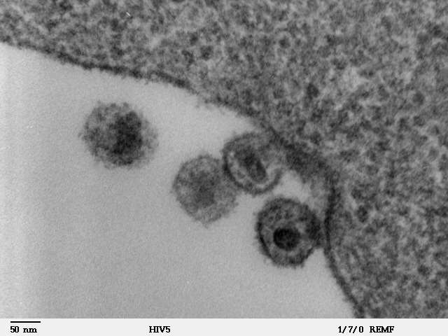 electron microscopy hiv