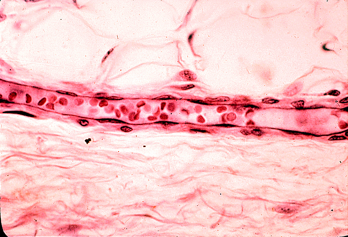 Scientific Image - Human Venule | NISE Network