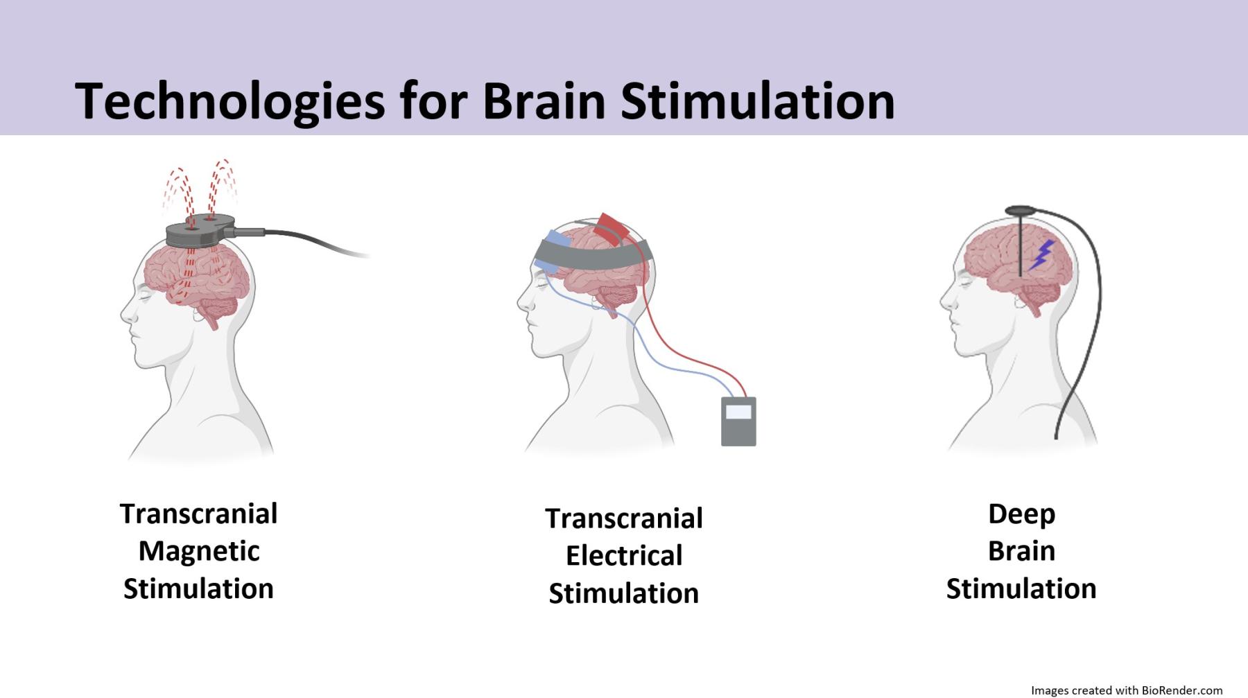 Diagrams showing different brain stimulation technologies 
